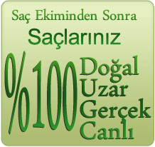 Saç Ekimi Sonrası %100 Gerçek, Doğal, Uzayan, Traş Edilebilir Saçlara Sahip Olacaksınız